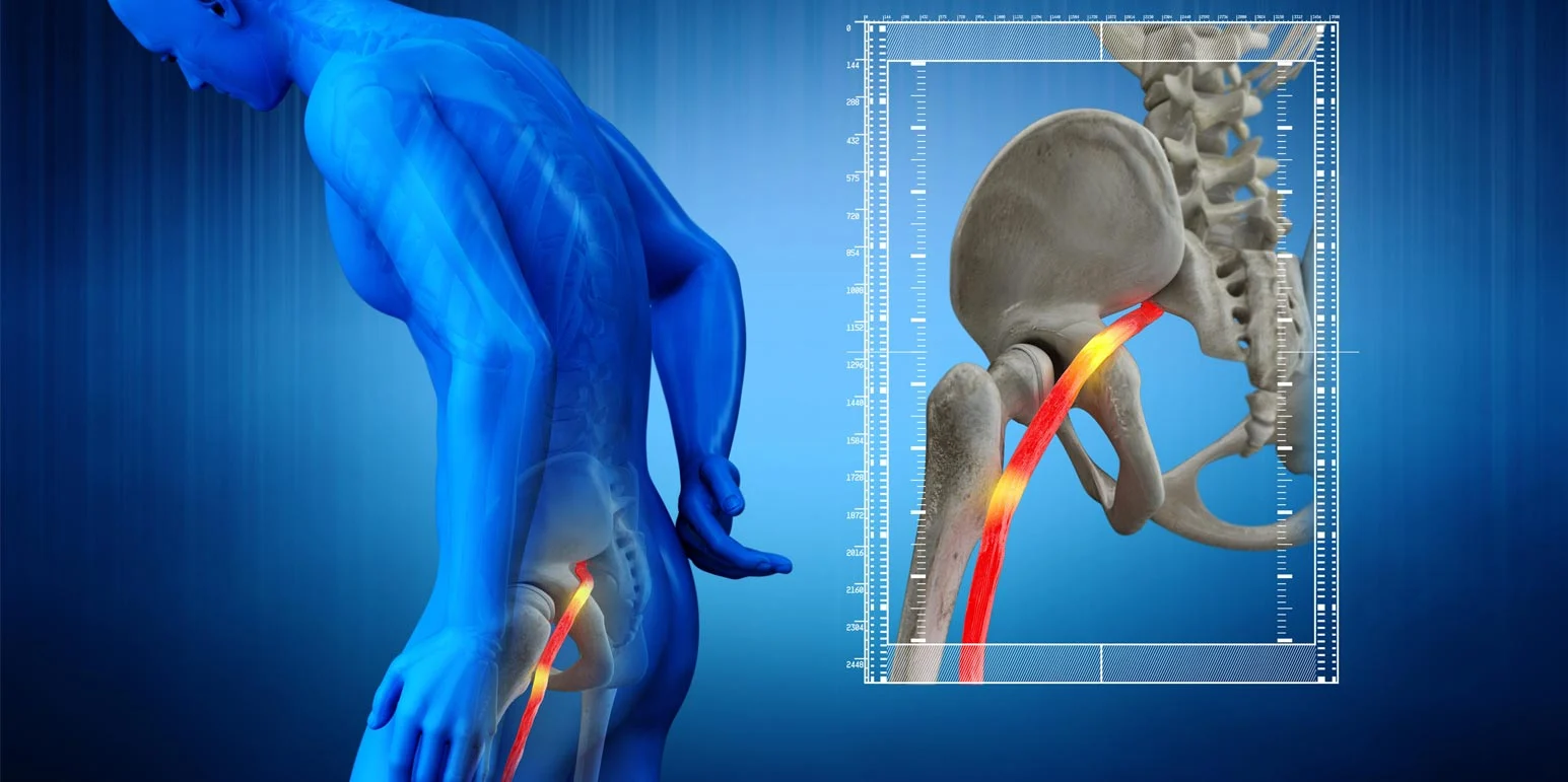Sciatica Banner https://demaiochiro.com/wp-content/uploads/2022/11/Sciatica-Banner.webp